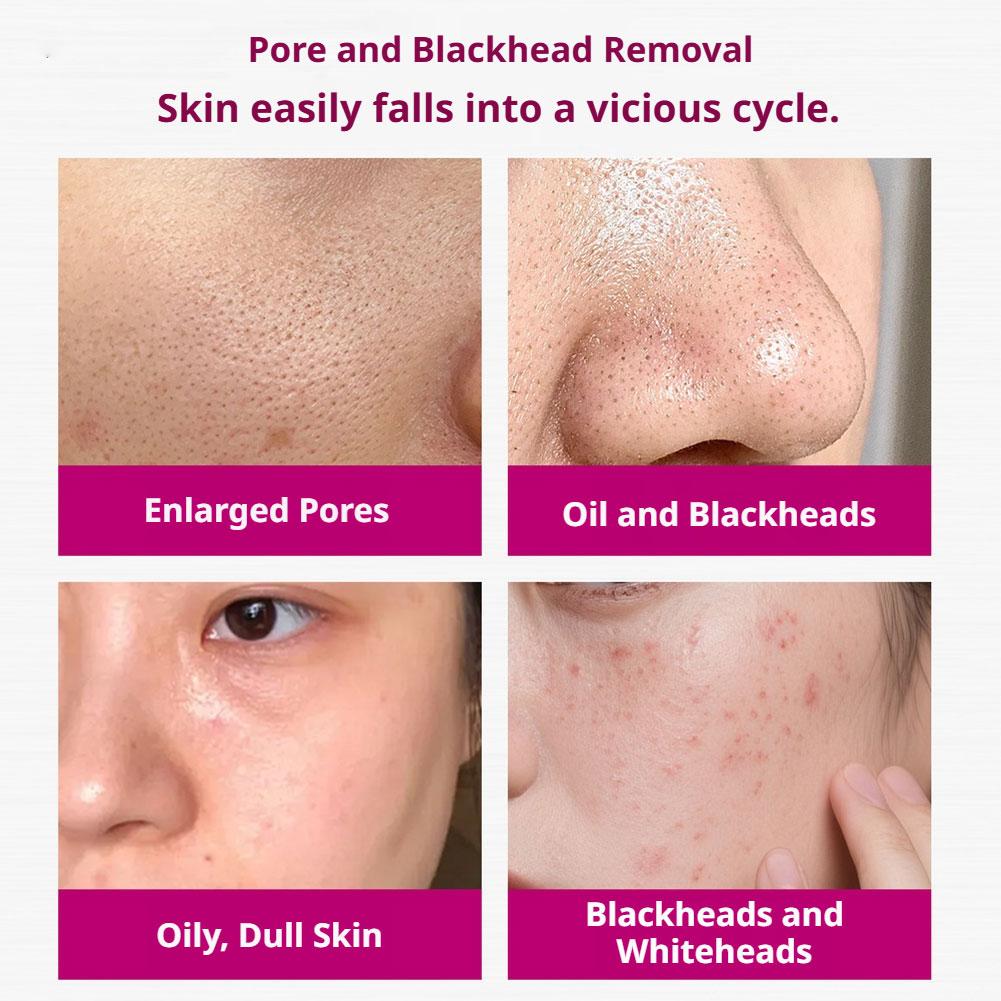 Salicylic Acid Shrink Pores Se - Tranexamic Acid Serum review and price