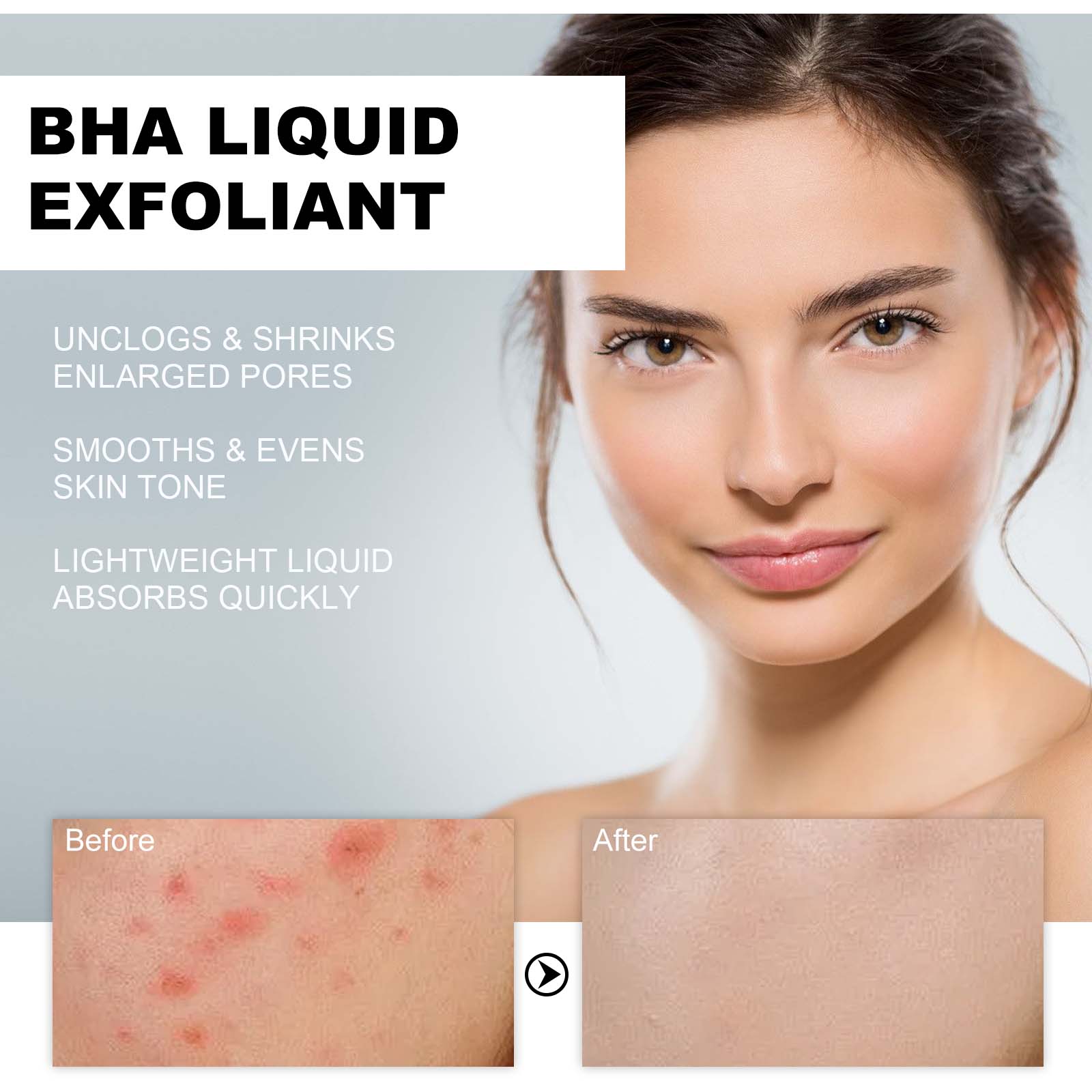 2% Salicylic Acid Liquid Exfol - Tranexamic Acid Serum review and price