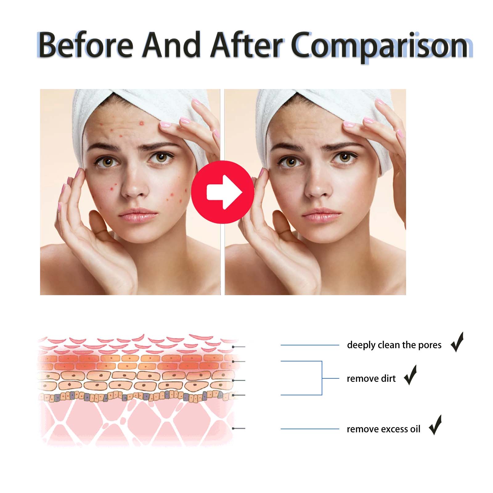 2% Salicylic Acid Liquid Exfol - Tranexamic Acid Serum review and price