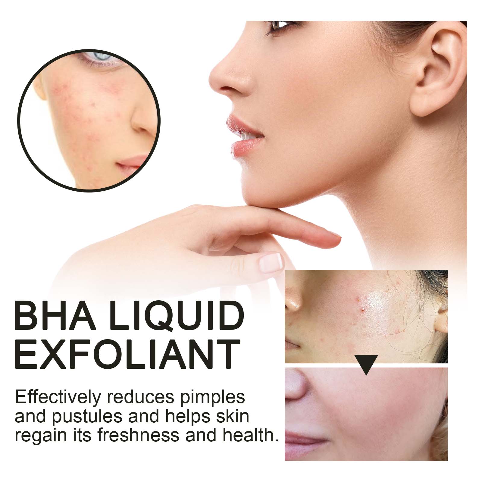 2% Salicylic Acid Liquid Exfol - Tranexamic Acid Serum review and price