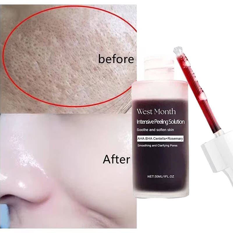 Feels Like Silk, Looks Like Fi - Tranexamic Acid Serum review and price
