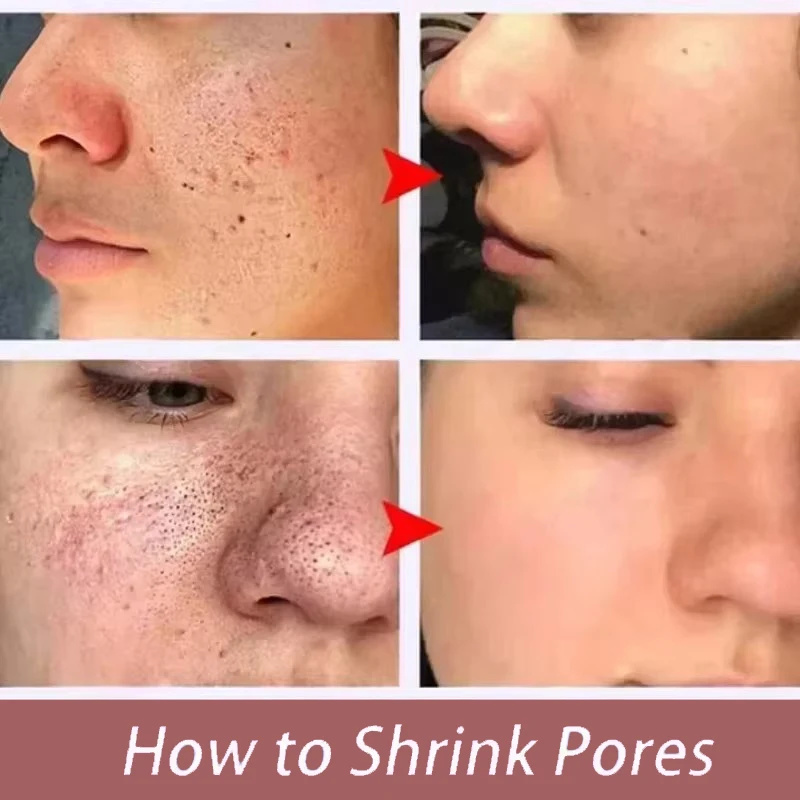 Feels Like Silk, Looks Like Fi - Tranexamic Acid Serum review and price