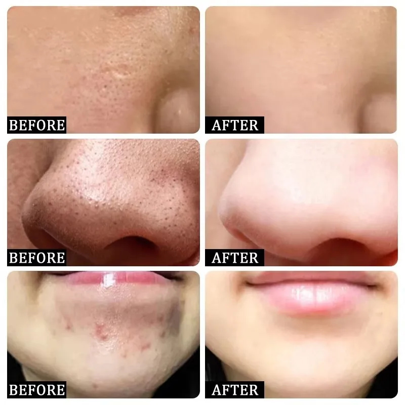 Feels Like Silk, Looks Like Fi - Tranexamic Acid Serum review and price