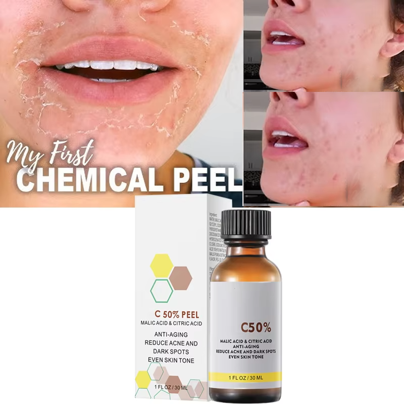 With Malic Acid And Citric Aci - Tranexamic Acid Serum review and price