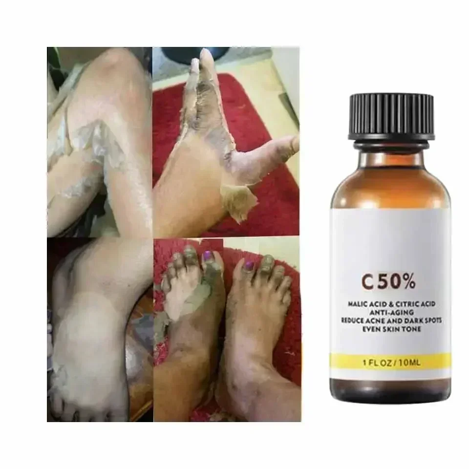 With Malic Acid And Citric Aci - Tranexamic Acid Serum review and price